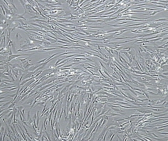 1616735566972228.jpg Human_Aortic_SMC.jpg
