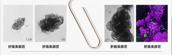 1681701514387036.png 肝癌.png