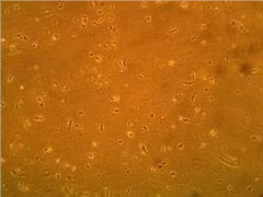 人前列腺微血管內(nèi)皮細(xì)胞（HPMEC）