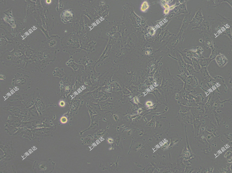 HS 578T人乳腺癌細(xì)胞