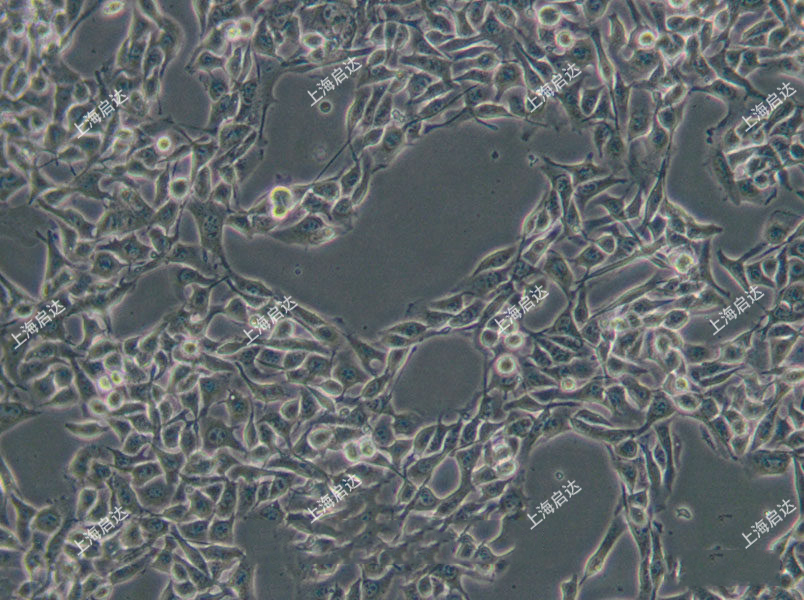 B16小鼠黑色素瘤細(xì)胞