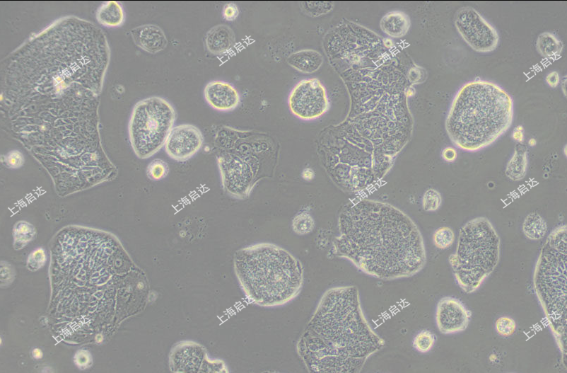 SW 1116人結(jié)腸腺癌細(xì)胞