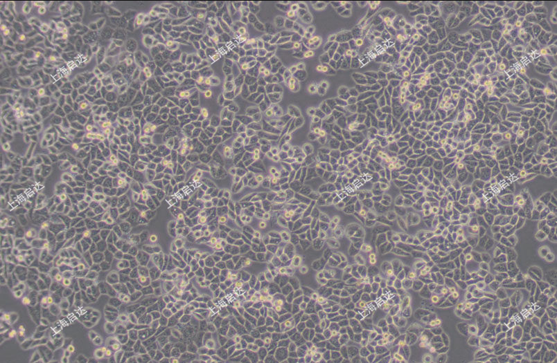 MDA-MB-468人乳腺癌細胞