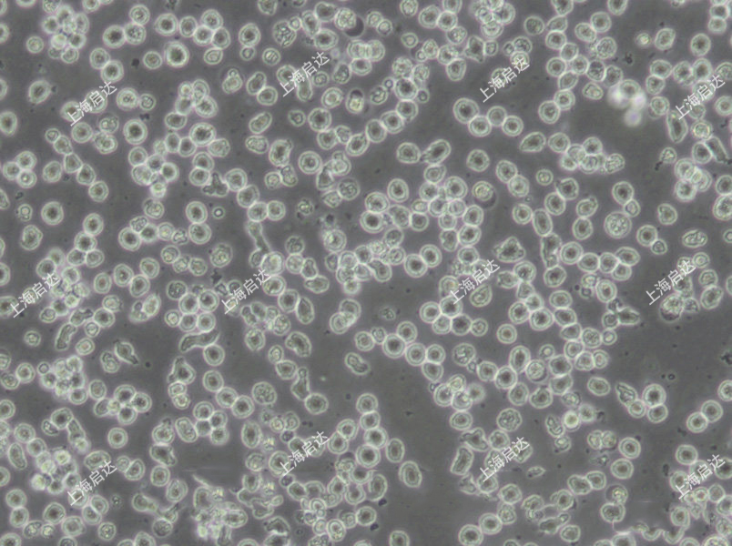 MOLT-4人急性淋巴母細(xì)胞白血病細(xì)胞