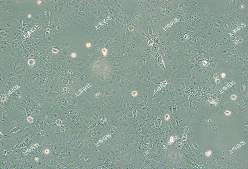 ScaBER人膀胱鱗癌細(xì)胞