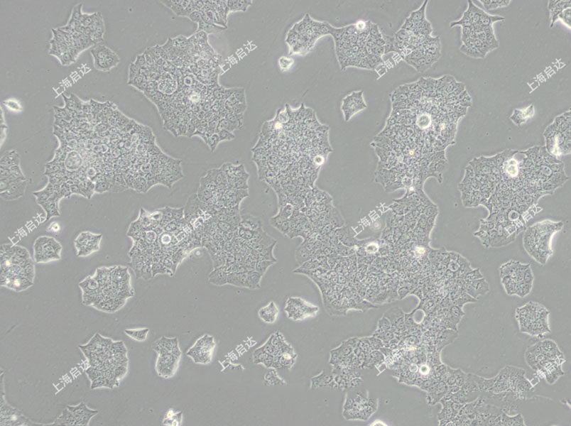 BT-474人乳腺導(dǎo)管癌細(xì)胞