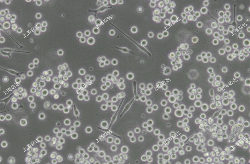 SK-MEL-1人皮膚黑色素瘤細(xì)胞