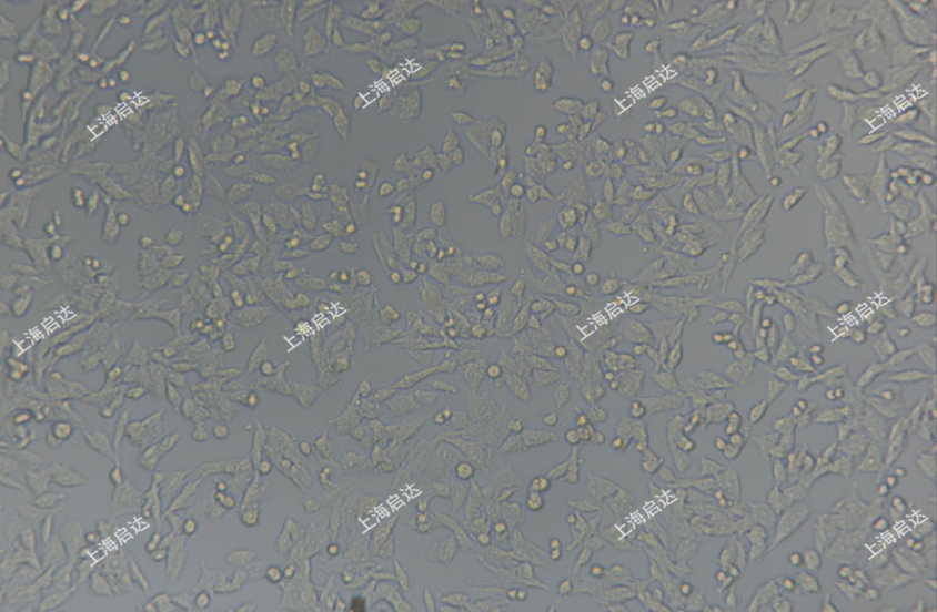 Y1小鼠腎上腺皮質(zhì)瘤細(xì)胞