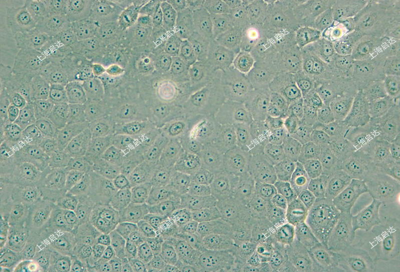 ScaBER人膀胱鱗癌細(xì)胞