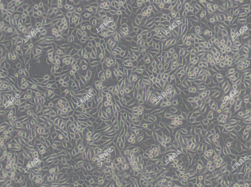 NCTC clone 929 [L cell, L-929, derivative of Strain L]小鼠胚胎成纖維細(xì)胞