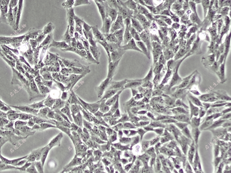 HSCT6大鼠肝星狀細(xì)胞