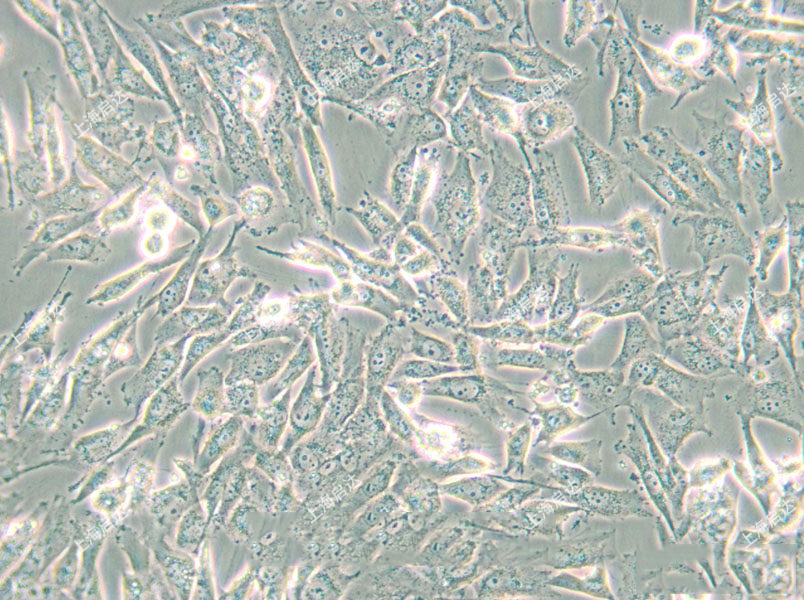 HS 683人腦膠質(zhì)瘤細(xì)胞