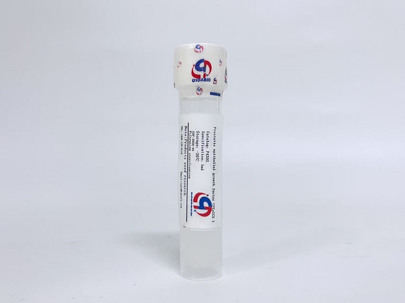 前列腺上皮細(xì)胞生長(zhǎng)因子PEpGCS